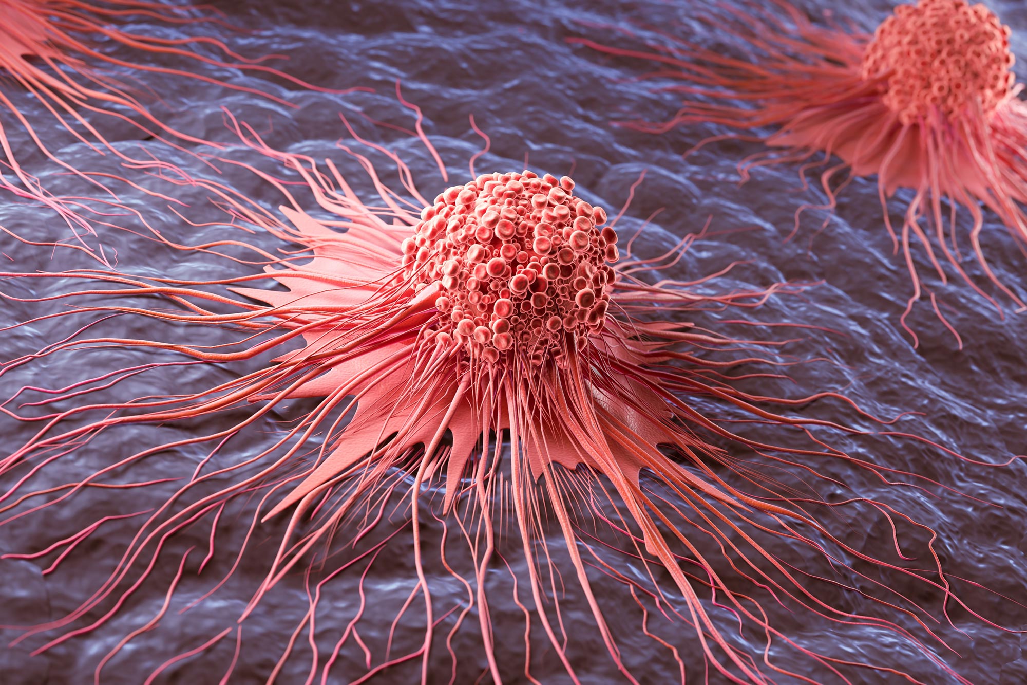 Molecule Discovered To Fuel Skin Cancer and Outsmart the Immune System