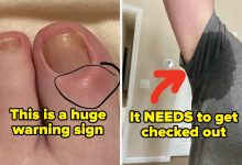 Medical Professionals Are Revealing The “Small” Health Signs You Should Never, Ever Ignore