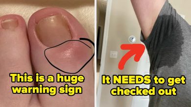 Medical Professionals Are Revealing The “Small” Health Signs You Should Never, Ever Ignore