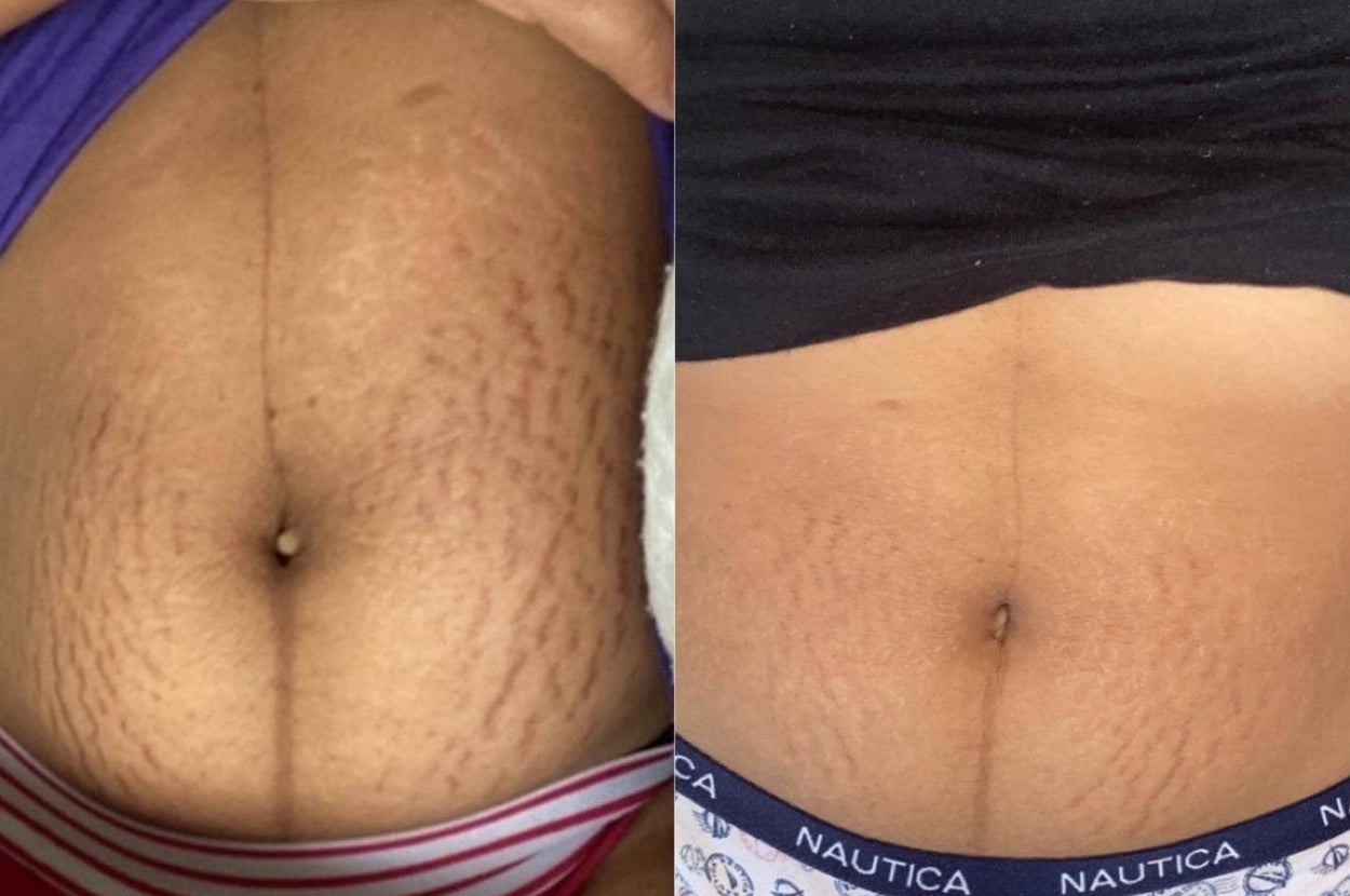 32 Products To Help Solve The Grooming Issues You Wish Would Disappear