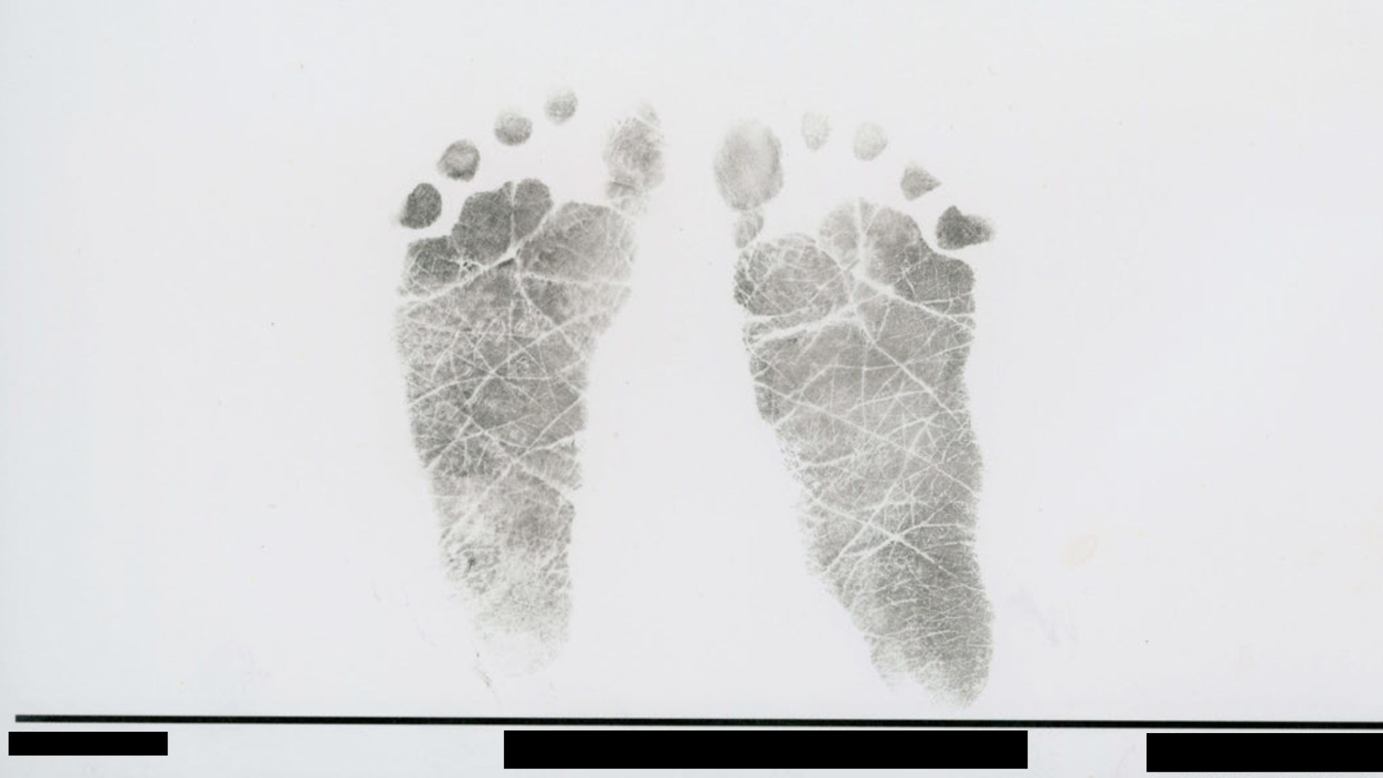Tiny Footprints, a Blue Blanket: What I Can’t Forget About the Babies Who Died of Vitamin K Deficiency