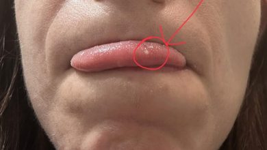These things.