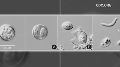 Cyclosporiasis parasitic illness cases in Maryland increase by dozens since May 1
