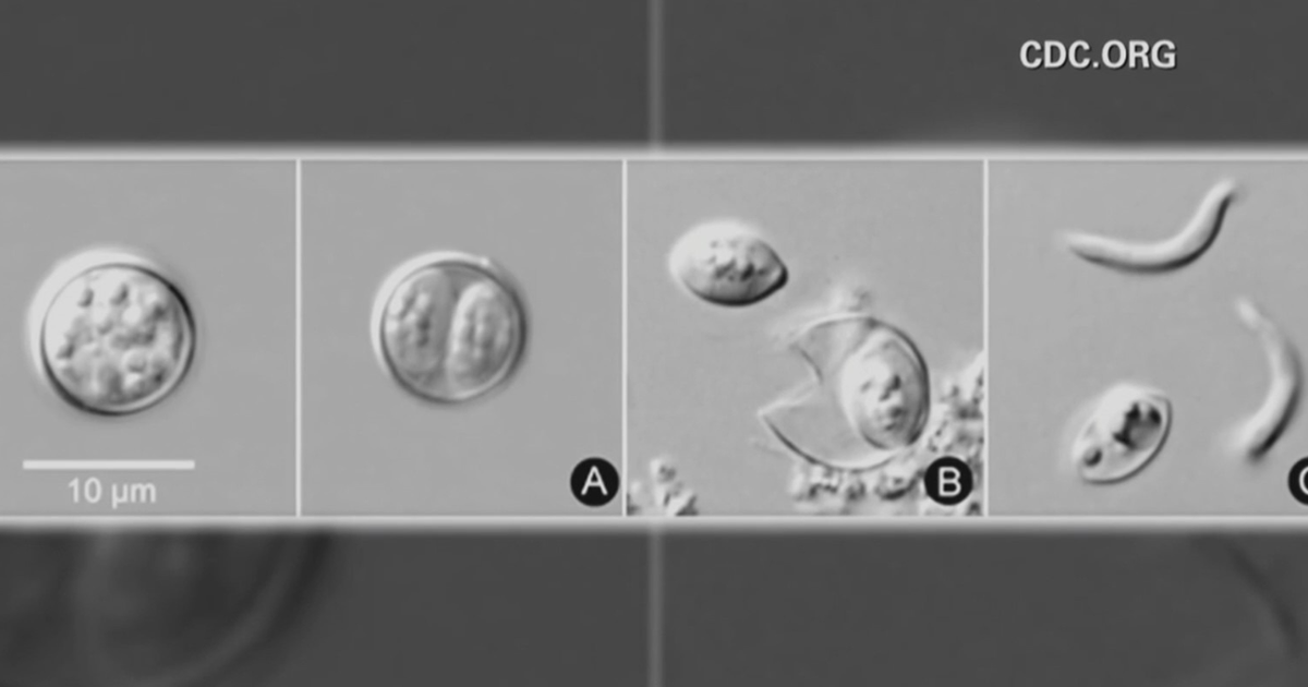 Cyclosporiasis parasitic illness cases in Maryland increase by dozens since May 1